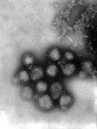Ａ香港型インフルエンザウイルスの電子顕微鏡写真（米疾病対策センター提供）