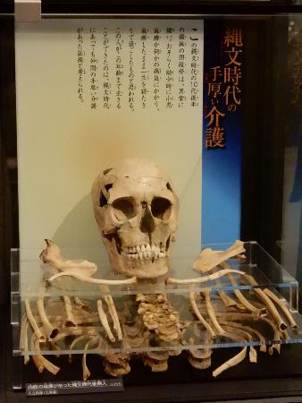 円尾さんが製作に関わった縄文時代後期の人骨のレプリカ（国立科学博物館提供）