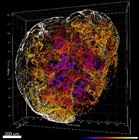 ｉＰＳ細胞から作製したミニサイズの血管状組織の顕微鏡写真（東京医科歯科大の佐伯憲和助教提供）