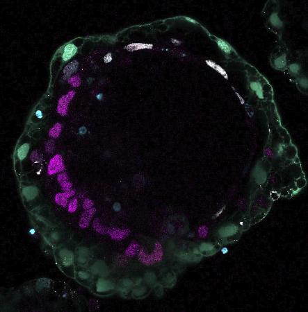 ｉＰＳ細胞などから作製した培養９日目の人の胚モデルの顕微鏡写真（京都大提供）