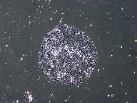 イヌの尿を使い作製したｉＰＳ細胞の顕微鏡写真（大阪公立大提供）