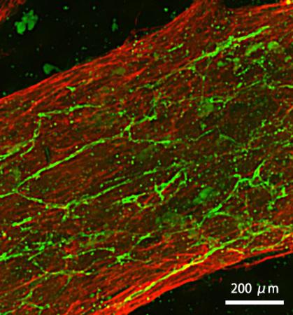 ｉＰＳ細胞から作ったミニ心臓組織の血管の顕微鏡写真（理化学研究所提供）