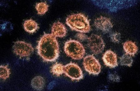 新型コロナウイルス（米国立アレルギー感染症研究所提供）
