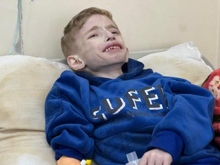 ガザ地区北部ベイトラヒヤのカマルアドワン病院で、栄養失調に苦しむぼうこう炎患者の６歳男児＝１０日（ゲッティ＝共同）