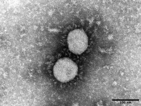 新規感染の中心となっているインド由来の新型コロナウイルス変異株「デルタ株」の電子顕微鏡写真（国立感染症研究所提供）